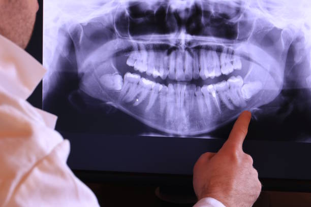 Best Broken or Chipped Tooth Repair in Elgin, SC