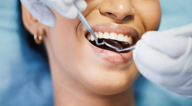 Best Emergency Dental Care for Sports Injuries in Elgin, SC