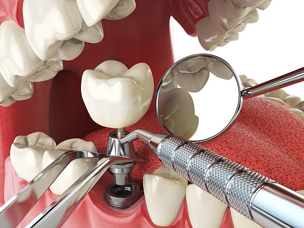 Best Emergency Denture Repair in Elgin, SC